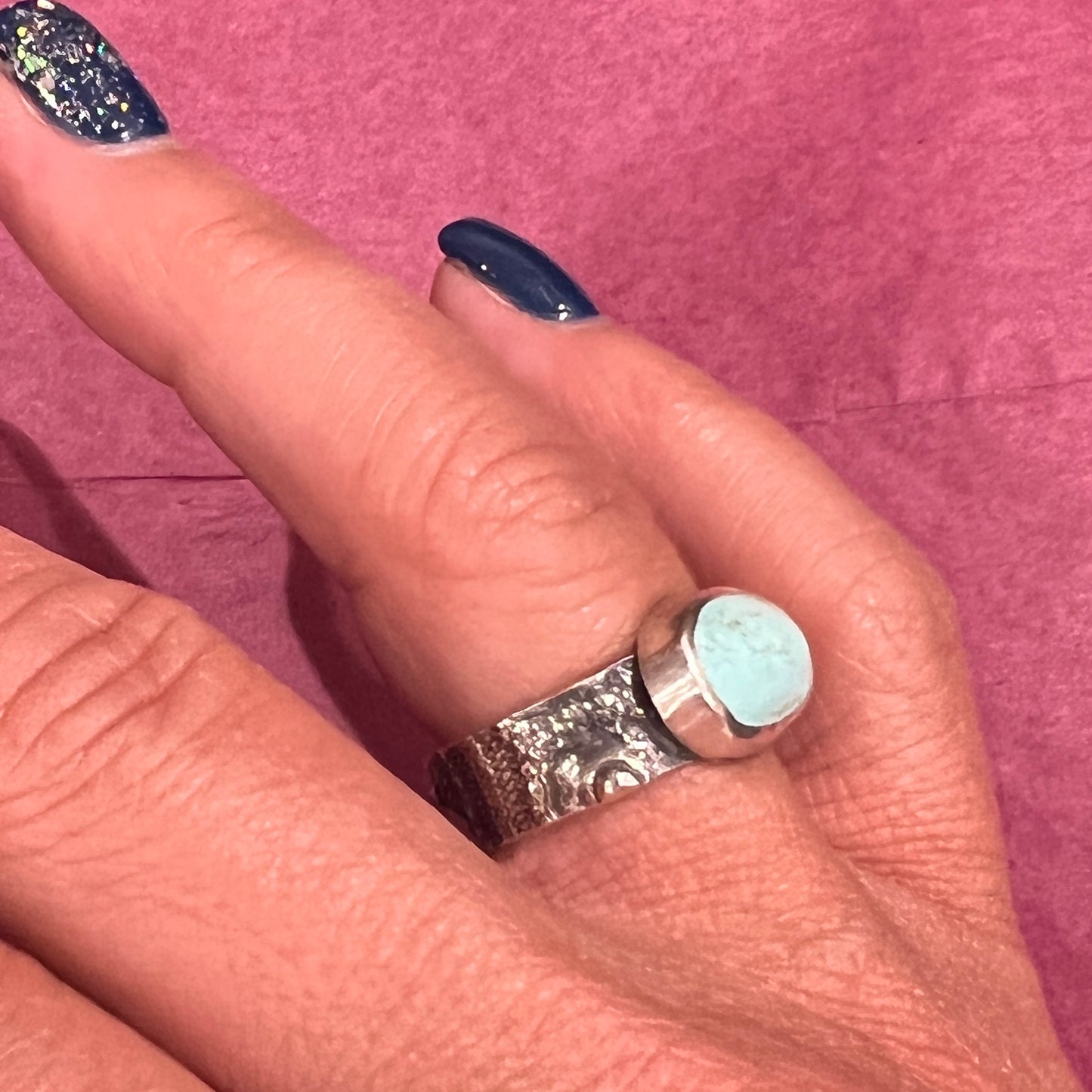 Turquoise Sea Urchin Ring